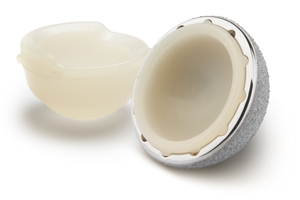 Trinity Advanced Bearing Acetabular System from Corin