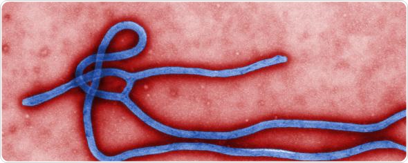 Microscopic view of Ebola virus