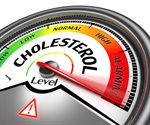 Cholesterol-lowering drugs could treat multiple sclerosis