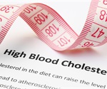 High cholesterol may not signal heart disease risk in metabolically healthy people
