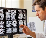 New radiology camera delivers sophisticated technology to Cambridge Medical Center patients