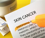 Higher melanoma rates linked to agricultural areas in Pennsylvania