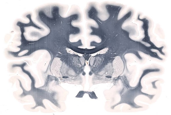Whole Mount Brain - 5 Whole Mount Brain - 5