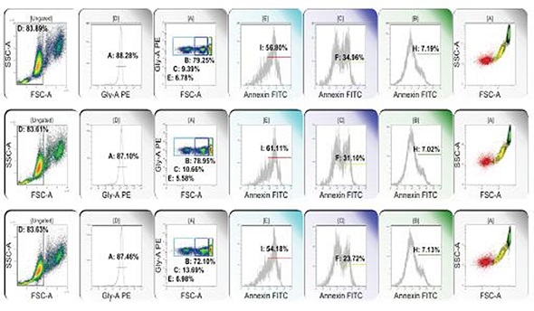 From left to right: RBC clusters are eliminated; glycophorin dim events are eliminated; glycophorin+ events are subsetted on the basis of forward light extinction into low, intermediate and high populations; annexin binding (surface phosphatidyl serine) is detected in low (E, red), intermediate (C, yellow), and high (B, green) forward light extinction populations. Color eventing annexin binding events on forward light extinction and side scatter reveals RBC microparticles (red), transitional events (yellow), and intact RBC (green).
