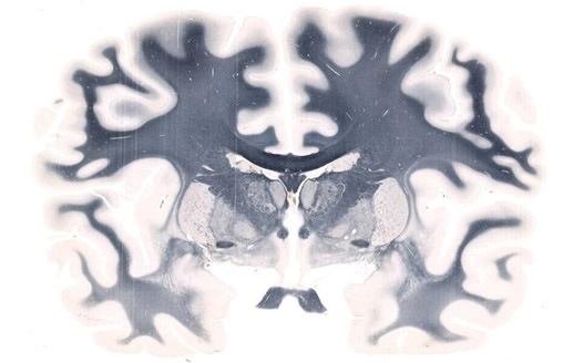 Whole-mount Brain scanned on a 5" x 7" slide at 20X resolution