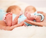 Birth Defects in Twins