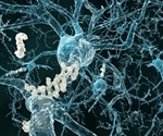 Restoring brain energy balance reverses Alzheimer’s disease in mouse models