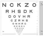 New test can detect early stages of sight loss in age-related macular degeneration