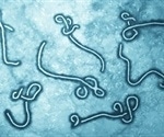 Research may lead to better treatment and vaccines for Ebola, COVID-19