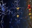 Two isoforms of a cellular energy sensor play distinct, opposing roles in Alzheimer's disease