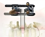 Research findings on K2M’s RAVINE® lateral access system to be presented at SpineWeek 2016