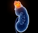 New antibody strategy shows promise for halting cyst growth in polycystic kidney disease