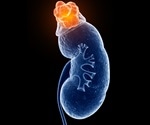 Glycosylation emerges as a key player in kidney disease progression