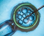 IVF improvements in United States