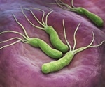 Helicobacter Pylori Tests