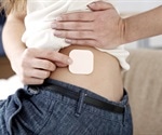 Advantages and Disadvantages of the Contraceptive Patch