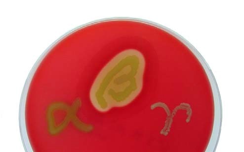 Hemolyses of Streptococcus spp. (left) α-hemolysis (S. mitis); (middle) β-hemolysis (S. pyogenes); (right) γ-hemolysis (= non-hemolytic, S. salivarius)