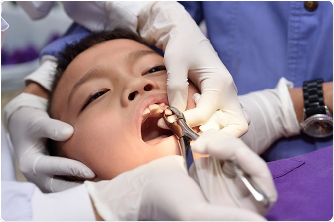 Boy during dental extraction. Image Credit: ARZTSAMUI / Shutterstock