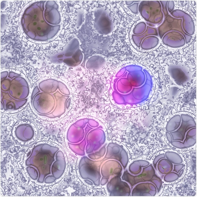 Leukemia cells Leukemia cells