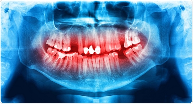 x-ray dentistry