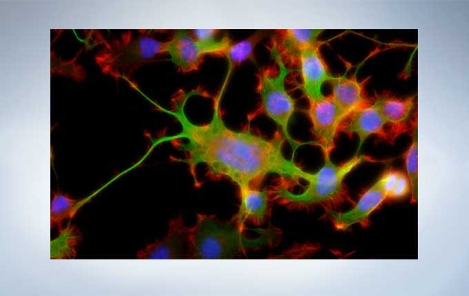 Vivid Fluorescence Images with Reduced Noise