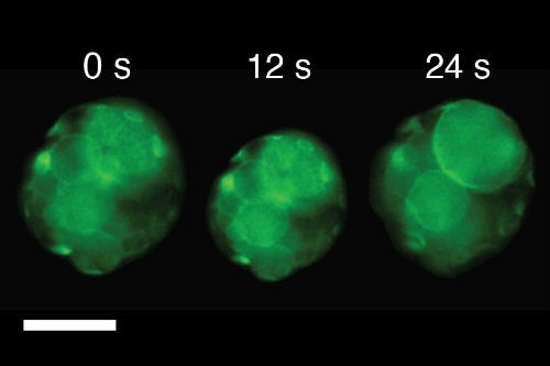 Dr Pierangelo Gobbo, Uni of Bristol Snapshots of video images showing a single cluster of artificial cells exhibiting a single beat-like oscillation as the temperature was changed above or below 37 ⁰C; scale bar, 50 μm. Dr Pierangelo Gobbo, Uni of Bristol Snapshots of video images showing a single cluster of artificial cells exhibiting a single beat-like oscillation as the temperature was changed above or below 37 ⁰C; scale bar, 50 μm.
