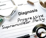 Progressive Supranuclear Palsy (PSP) Causes