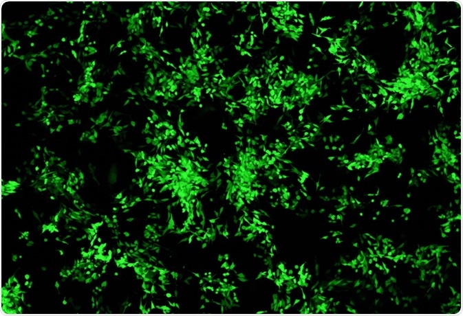 Breast cancer cells imaged with green fluorescent protein - By DrimaFilm
