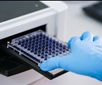 Enzyme-linked Immunosorbent Assay (ELISA): Methodology