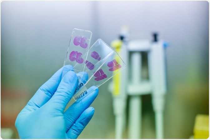 Histopathologist holding three microscope slides stained with hematoxylin & eosin - by Vshivkova