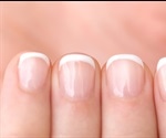 Types of Nail Disease