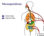 Immunology of Microsporidiosis