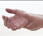 Environmental pollutants found to worsen rheumatoid arthritis