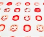 Whole genome sequencing could prevent transfusion reactions