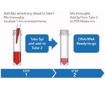 A Novel Blood Processing Technology for Simple and Rapid Molecular Diagnosis of Candidiasis