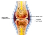 Osteoarthritis and Diet