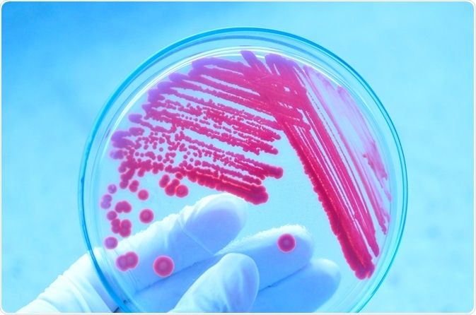 Microbiologist examining agar plate of pink bacteria