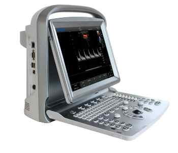 Sonologic's ECO 5 Ultrasound System