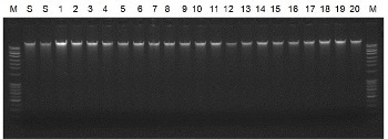 Saliva DNA Isolation 96-Well Kit from Bio-Synthesis