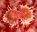 Novel antisense oligonucleotide shows promise against aggressive pancreatic cancer