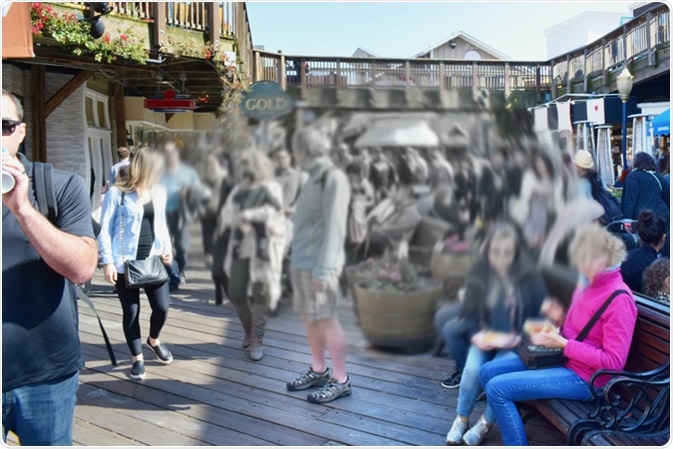 Macular degeneration (AMD or ARMD)- is a medical condition which may result in blurred or no vision in the center of the visual field. Image Credit: Tunatura / Shutterstock