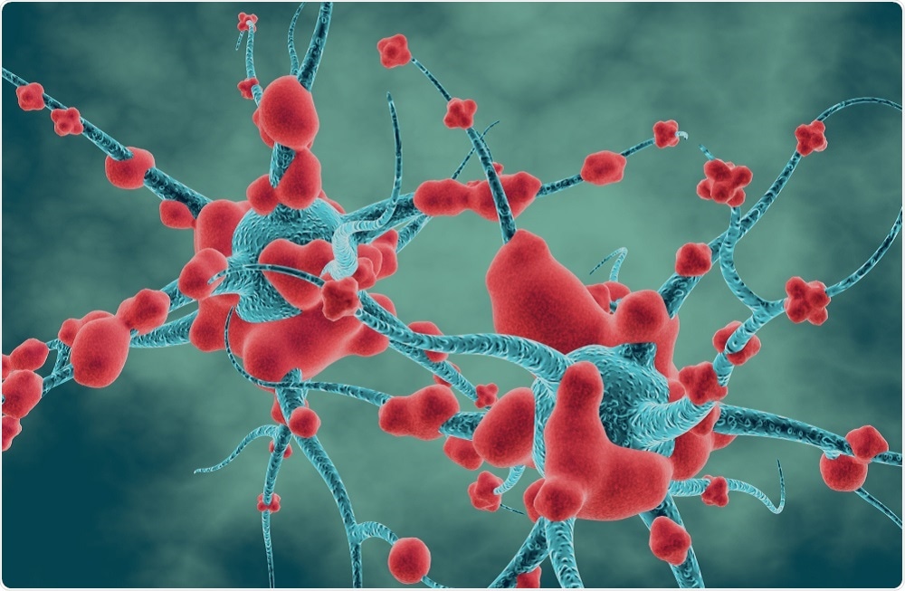 Senescent cells in the brain - an illustration by Illustration Forest