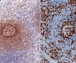 Enzymatic Immunohistochemistry (IHC)