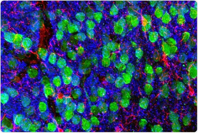 Imaging the brain. Medial prefrontal cortex demonstrating cortical neurons (green), microglia (red), and the post-synaptic marker PSD95 (blue). Image courtesy of Drs. Christopher Parkhurst and David Artis (WCM).