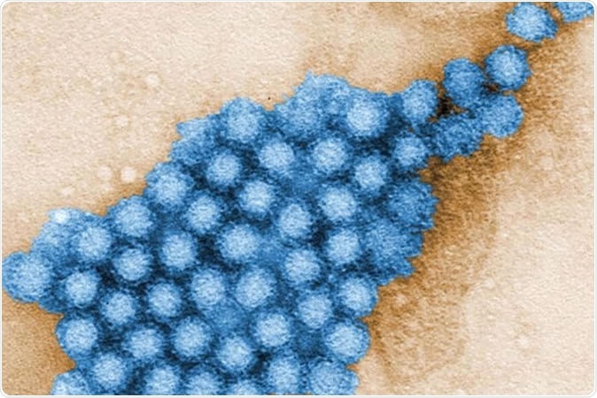 A new study led by Washington University School of Medicine in St. Louis reveals details about how gut microbes interact with norovirus infection in the mouse gut. The research opens up new ways of thinking about potential therapies for this intestinal infection. Shown are Norovirus particles. CDC/ CHARLES D. HUMPHREY