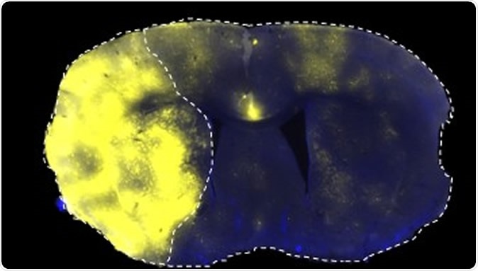 Fluorescently labelled liposomes selectively translocated into the stroke area left side of brain 1