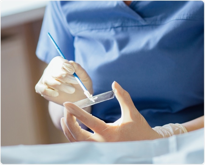 Women need to have a cervical screening test every five years from the age of 25. The Pap smear, also called a Pap test, is a procedure performed at a GP surgery to test for cervical cancer in women. Image Credit: Iryna Inshyna / Shutterstock