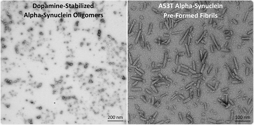 (L) TEM of Dopamine-Stabilized Alpha-Synuclein Oligomers (R) TEM of A53T Alpha-Synuclein PFFs.
