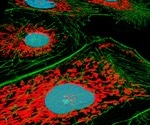 Studying Organelle Diversity using Immunofluorescent Array Tomography