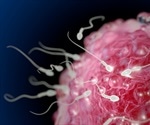 Female reproductive tract blocks weak sperm from reaching egg